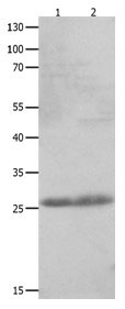 CLEC4D Antibody in Western Blot (WB)