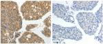 GRK4 Polyclonal Antibody