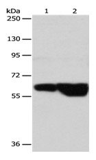 GRK4 Antibody in Western Blot (WB)