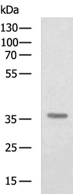 CFHR1 Antibody in Western Blot (WB)