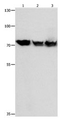 HSP90B2P Antibody in Western Blot (WB)