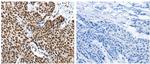 Kallikrein 7 Antibody in Immunohistochemistry (Paraffin) (IHC (P))