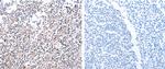 PDCD10 Polyclonal Antibody