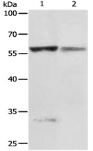 PRCP Antibody in Western Blot (WB)