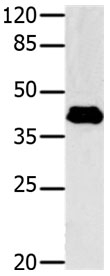 GNAZ Polyclonal Antibody