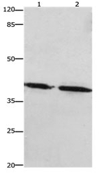 PTGER1 Polyclonal Antibody