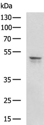 KISS1R Antibody in Western Blot (WB)