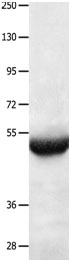 BPIFB3 Antibody in Western Blot (WB)