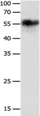 CHRNA3 Antibody in Western Blot (WB)