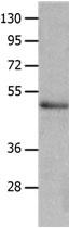 NCK2 Antibody in Western Blot (WB)