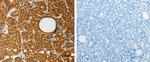 AKR1A1 Polyclonal Antibody