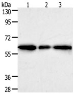 AKR1A1 Antibody in Western Blot (WB)