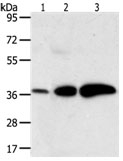 AKR1C1 Antibody in Western Blot (WB)