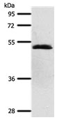 SCTR Antibody in Western Blot (WB)