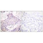 CARD6 Antibody in Immunohistochemistry (Paraffin) (IHC (P))
