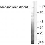 CARD6 Antibody in Western Blot (WB)