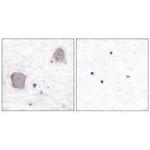 mGluR4 Polyclonal Antibody