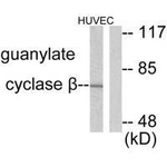 GUCY1B3 Antibody in Western Blot (WB)