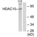 HDAC10 Antibody in Western Blot (WB)