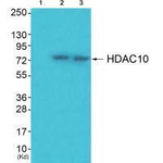 HDAC10 Antibody in Western Blot (WB)