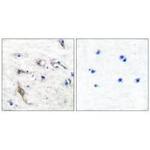 JM4 Polyclonal Antibody