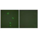 MCM5 Polyclonal Antibody