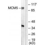 MCM5 Antibody in Western Blot (WB)