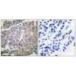 MMP8 Antibody in Immunohistochemistry (Paraffin) (IHC (P))