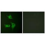 CDKN2B Polyclonal Antibody