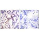 CDKN2B Antibody in Immunohistochemistry (Paraffin) (IHC (P))