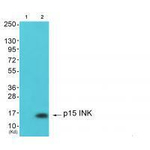 CDKN2B Antibody in Western Blot (WB)