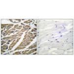 Sodium Channel Pan Polyclonal Antibody