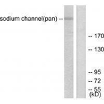 Sodium Channel Pan Antibody in Western Blot (WB)