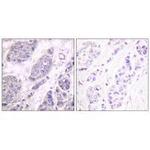 TGF beta-3 Polyclonal Antibody
