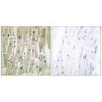 PDLIM1 Antibody in Immunohistochemistry (Paraffin) (IHC (P))