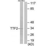 FOXE1 Polyclonal Antibody