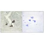 EphB6 Antibody in Immunohistochemistry (Paraffin) (IHC (P))