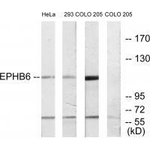 EphB6 Antibody in Western Blot (WB)