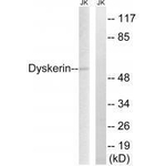 DKC1 Antibody in Western Blot (WB)