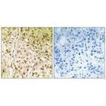 POLQ Polyclonal Antibody