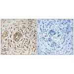KIP2 Polyclonal Antibody