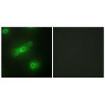 APRIL Polyclonal Antibody