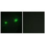 MYST2 Polyclonal Antibody