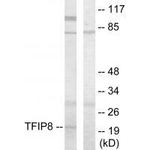 TNFAIP8 Antibody in Western Blot (WB)