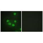 SIX6 Polyclonal Antibody