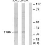 SIX6 Antibody in Western Blot (WB)