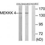 HGK Antibody in Western Blot (WB)