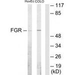 FGR Antibody in Western Blot (WB)