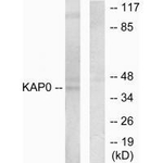 PRKAR1A Antibody in Western Blot (WB)