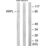 PFKL Antibody in Western Blot (WB)